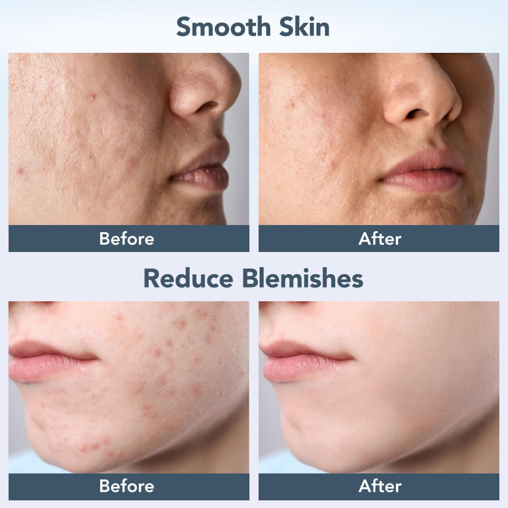 เครื่องล้างหน้าอัจฉริยะ FOREO LUNA 4 Balanced Skin